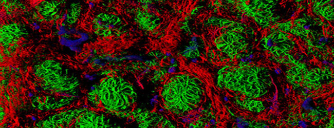 Notes on two-photon&nbsp;microscopy