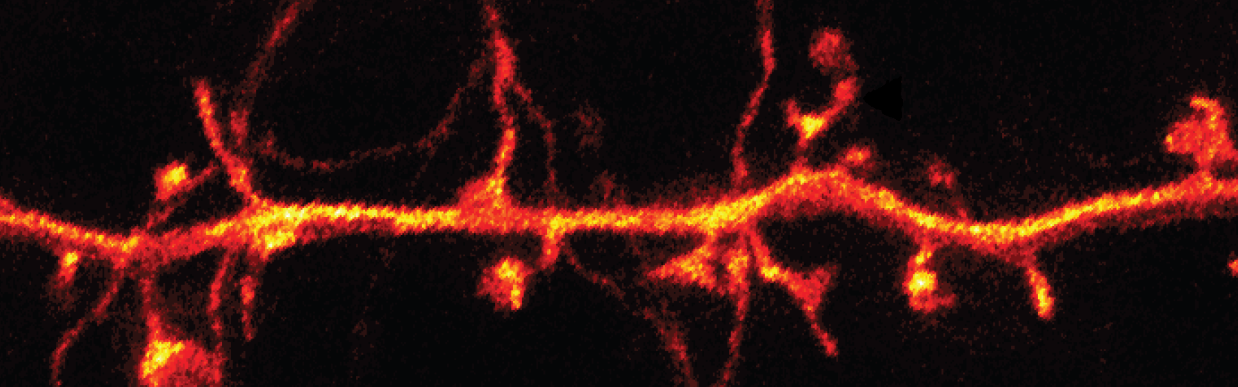 superresolution microscopy in vivo