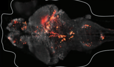 whole-brain recording from larval zebrafish