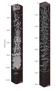 3-photon microscopy