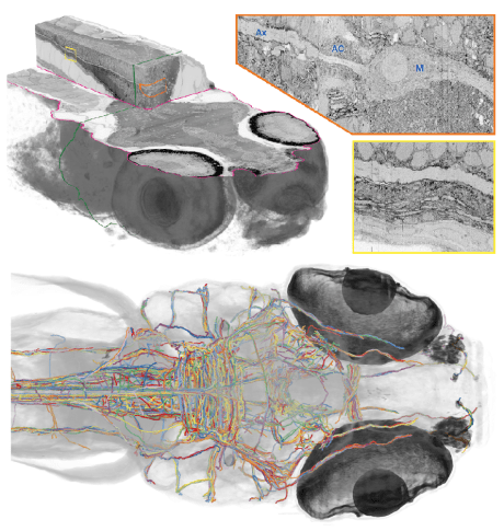 SSEM of larval zebrafish brain