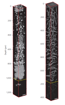 3-photon microscopy