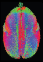 BrainMINDS marmoset tractography
