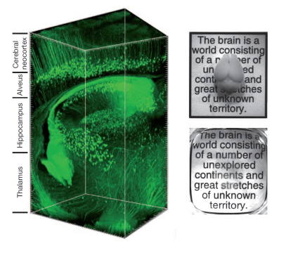 CLARITY Imaging Technique