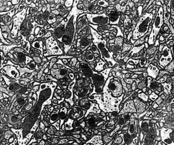 Multibeam SEM sample image