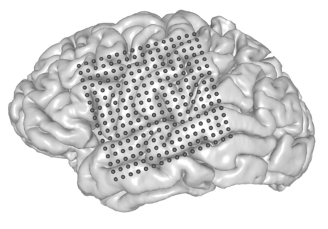 Speech synthesis from brain activity ECoG