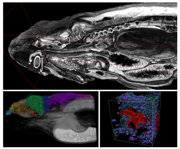 Synchrotron imaging of whole zebrafish